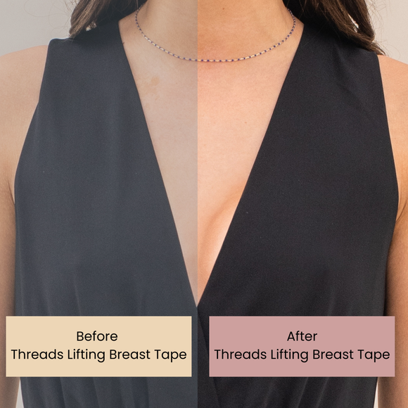 Threads Extra-Wide Lifting Breast Tape (7.5cm x 5m Roll)